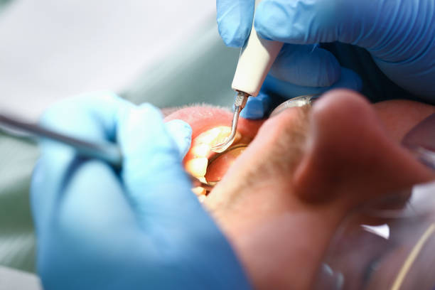 Best Weekend Emergency Dentist in Tioga, TX