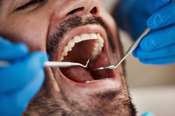 Best Pediatric Emergency Dentist in Tioga, TX