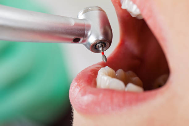 Best Emergency Dental Services for Seniors in Tioga, TX
